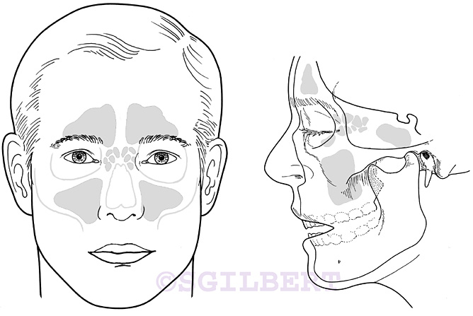 paranasal sinuses